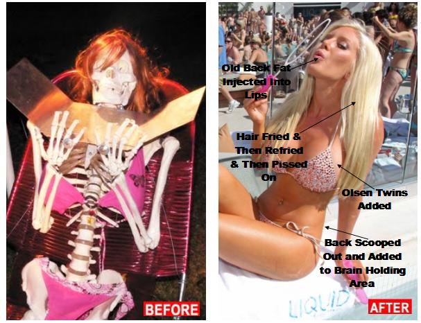 heidi montag before and after. However, Heidi Montag is not