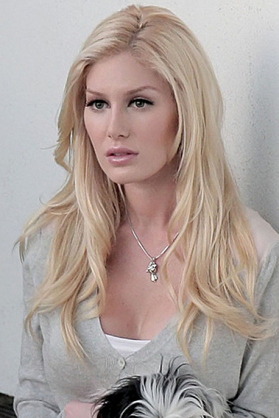 heidi montag before and after plastic surgery interview. Heidi Montag Plastic Surgery